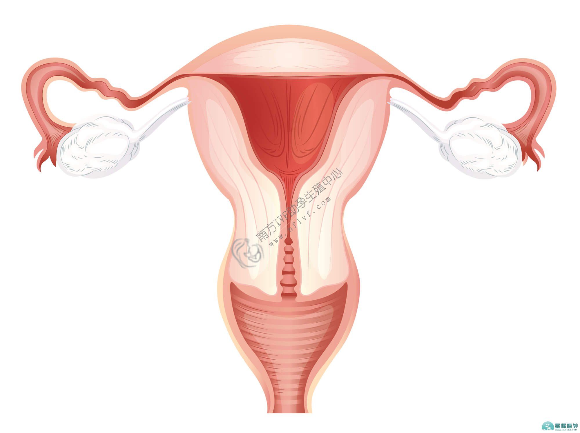 长沙50岁三代试管婴儿医院排名-对卵巢囊肿有哪些预防措施？卵巢囊肿如何才能得到良好的治疗？
